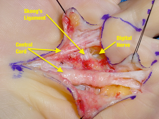Close up view of central cords, Skoog's pigments and location of neuromuscular bundles.