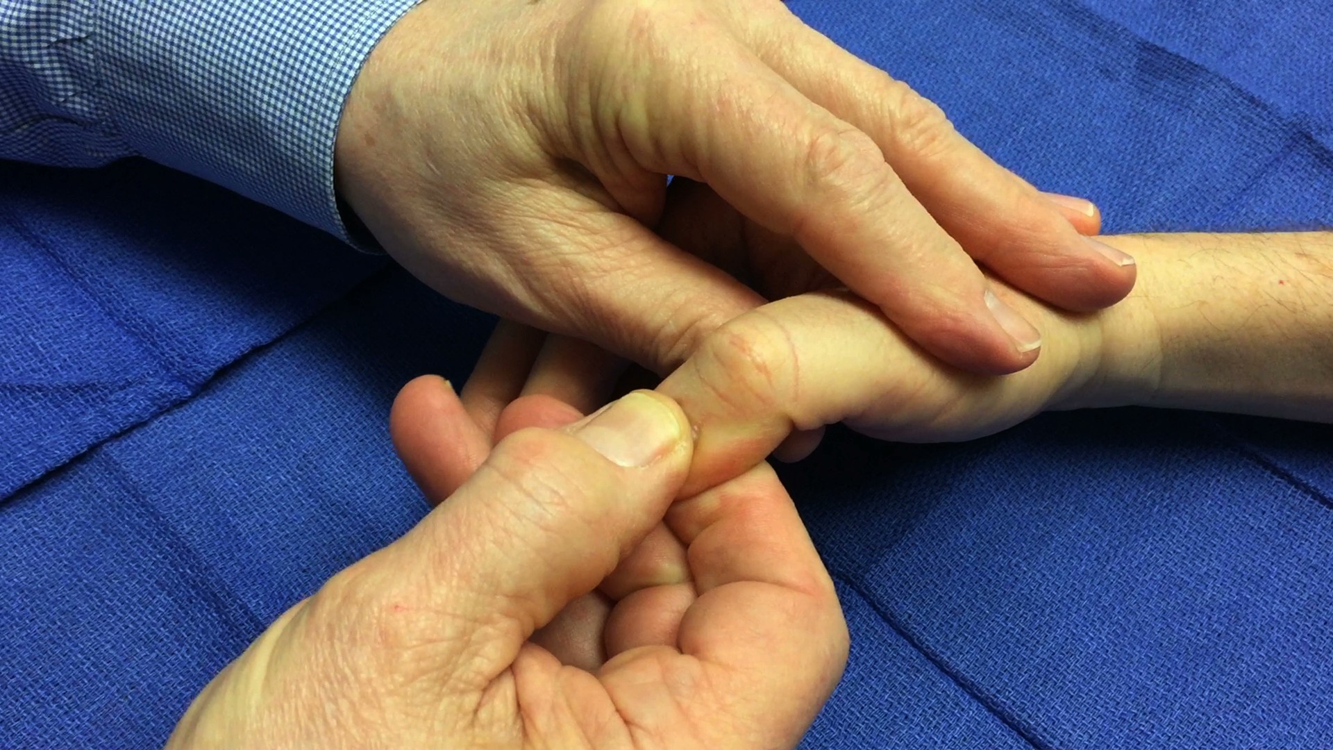 To Assess capillary refill first compress the nail bed,