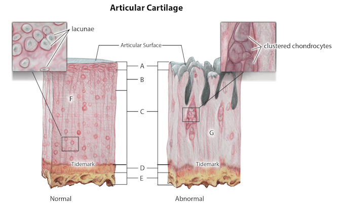 Normal and Osteoarthritic Cartilage Anatomy