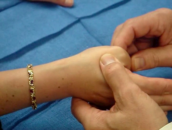 Alternative Finckelstein manuever - The wrist is in neutral position while the thumb MP joint is maximally flexed. This pulls the EPB through the first extensor compartment and reproduces the patient's pain.