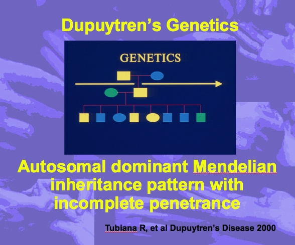 Dupuytren's Disease Basic Science