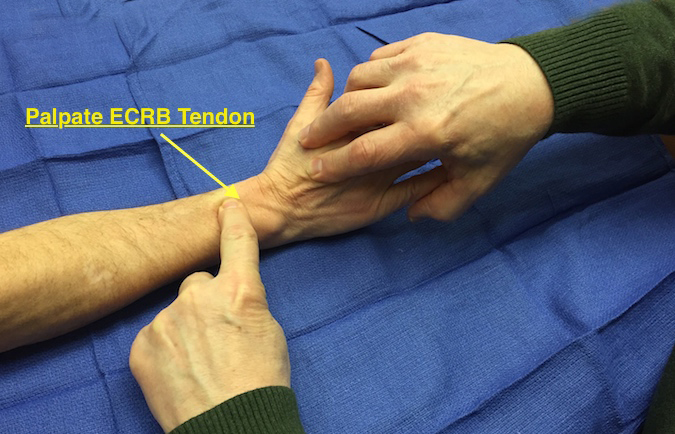 ECRB Muscle Test. Tendon palpated at RC join level while patient extends wrist against resistance.
