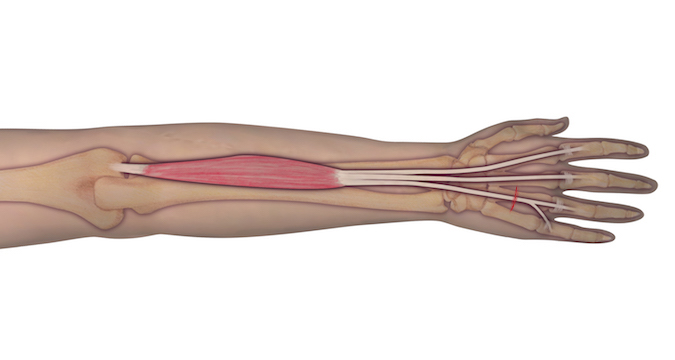 This illustration represents the anatomy of the muscle and tendon origin and insertion. Should an individual sustain a laceration as depicted, the observer can assume that the underlying tendon may be at risk for complete transection. A proper examination is needed to determine the integrity of the tendon.