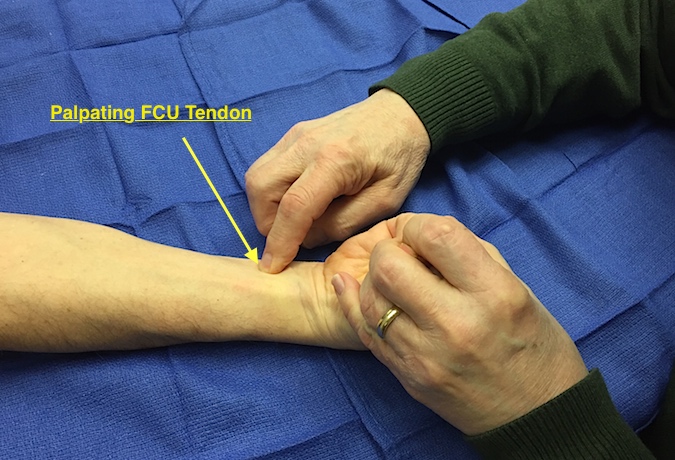 FCU Muscle Testing. Patient palmar flexes wrist against resistance while FCU Tendon palpated.