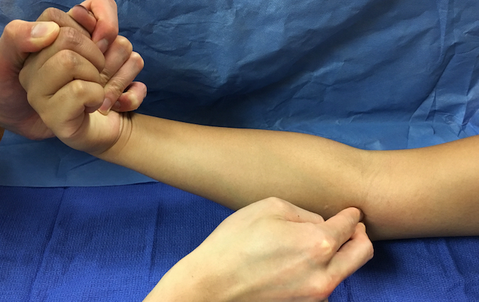 Palpating the flexor origin at the anterior medial epicondyle for tenderness while resisting the patient's active wrist palmar flexion. (Hover over right edge to see more images)