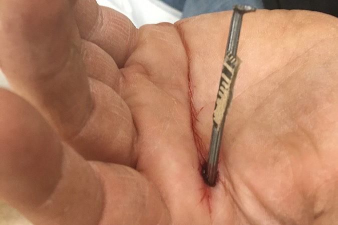 Nail Gun Injury to base of left index finger