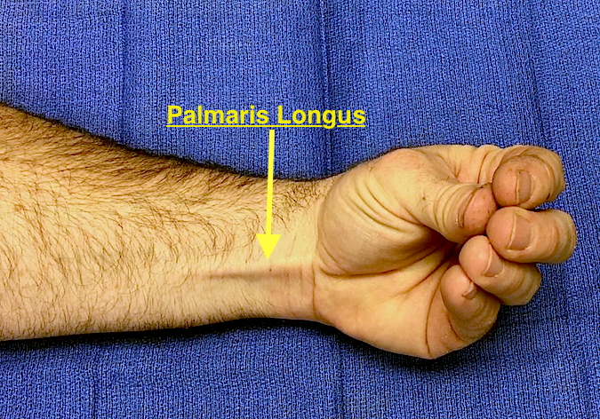 Palmaris Longus Muscle Testing