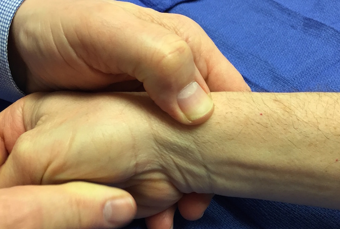 Thumb palpating first extensor compartment for tenderness 