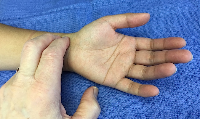 Palpating Radial Artery pulse at wrist