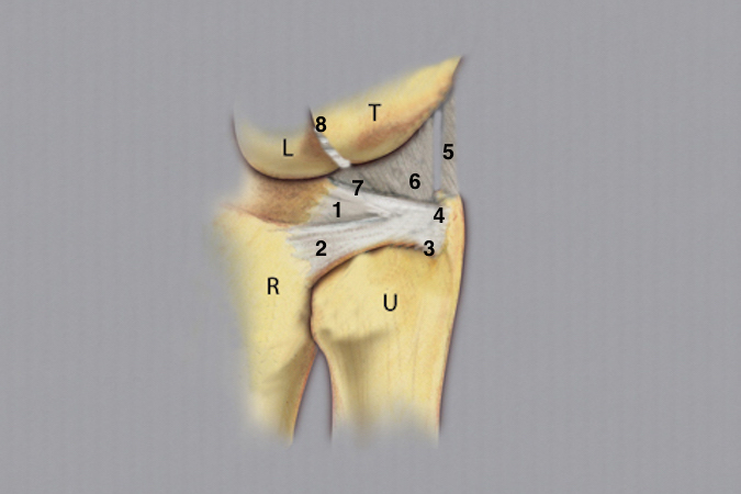 TFCC & DRUJ: T - Triquetrum; L - Lunate; R - Radius; U - Ulnar head; 1- TFC articular disc; 2- Dorsal radioulnar ligament; 3- Deep radioulnar (foveal or ligament subcruentum) insertion; 4- Ulnar styloid TFCC insertion; 5- Ulnar collateral ligament (floor of the ECU tendon sheath; 6- Ulnotriquetral and ulnolunate ligaments; 7- Palmar (volar or anterior) radioulnar ligament; 8- Lunotriquetral ligament.