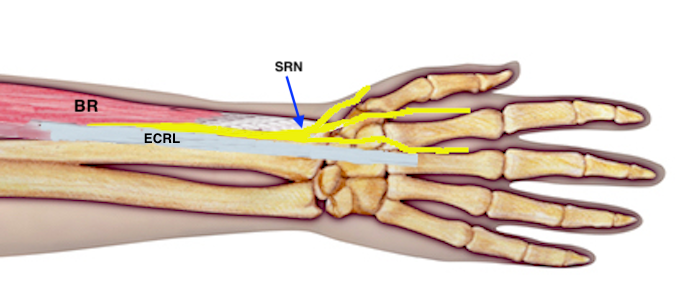 Note the superficial radial sensory nerve (SRN) entering the subcutaneous tissue by passing through the interval between the brachioradialis (BR) and the extensor carpi radialis longus (ECRL).